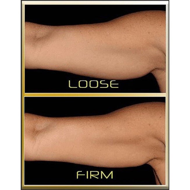 Thermoslim Arms Wellness, , on-hover image number 1